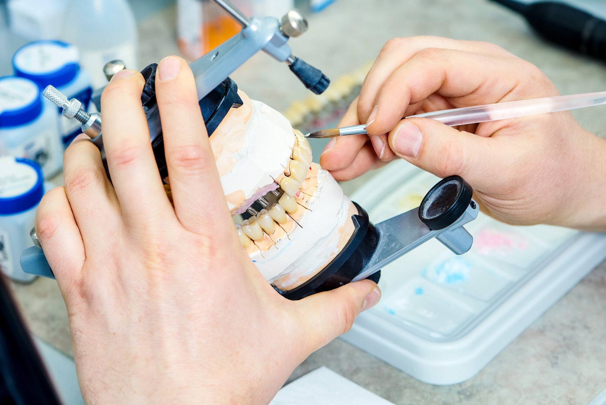 Picture of dental technology